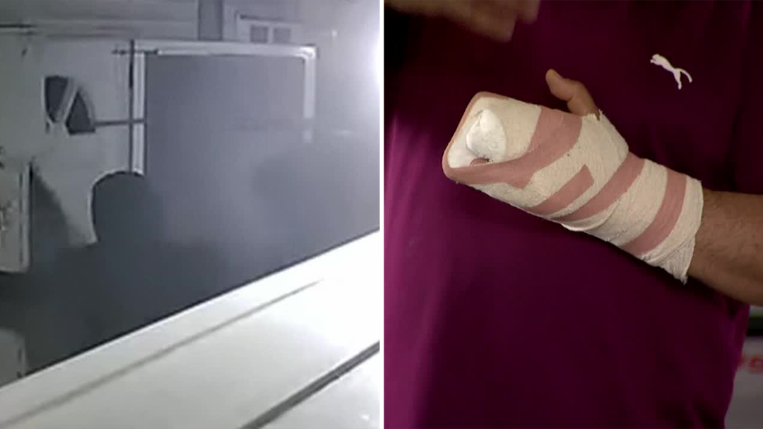 Teacher’s hand sliced by axe in home invasion